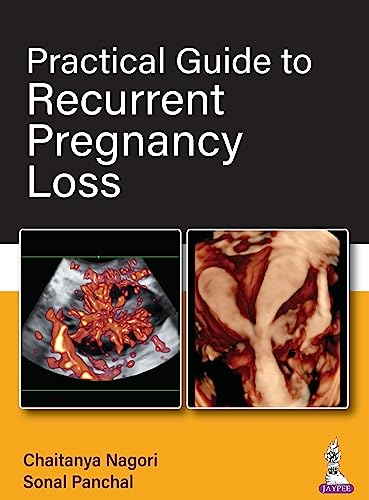 Practical Guide to Recurrent Pregnancy Loss  by Chaitanya Nagori