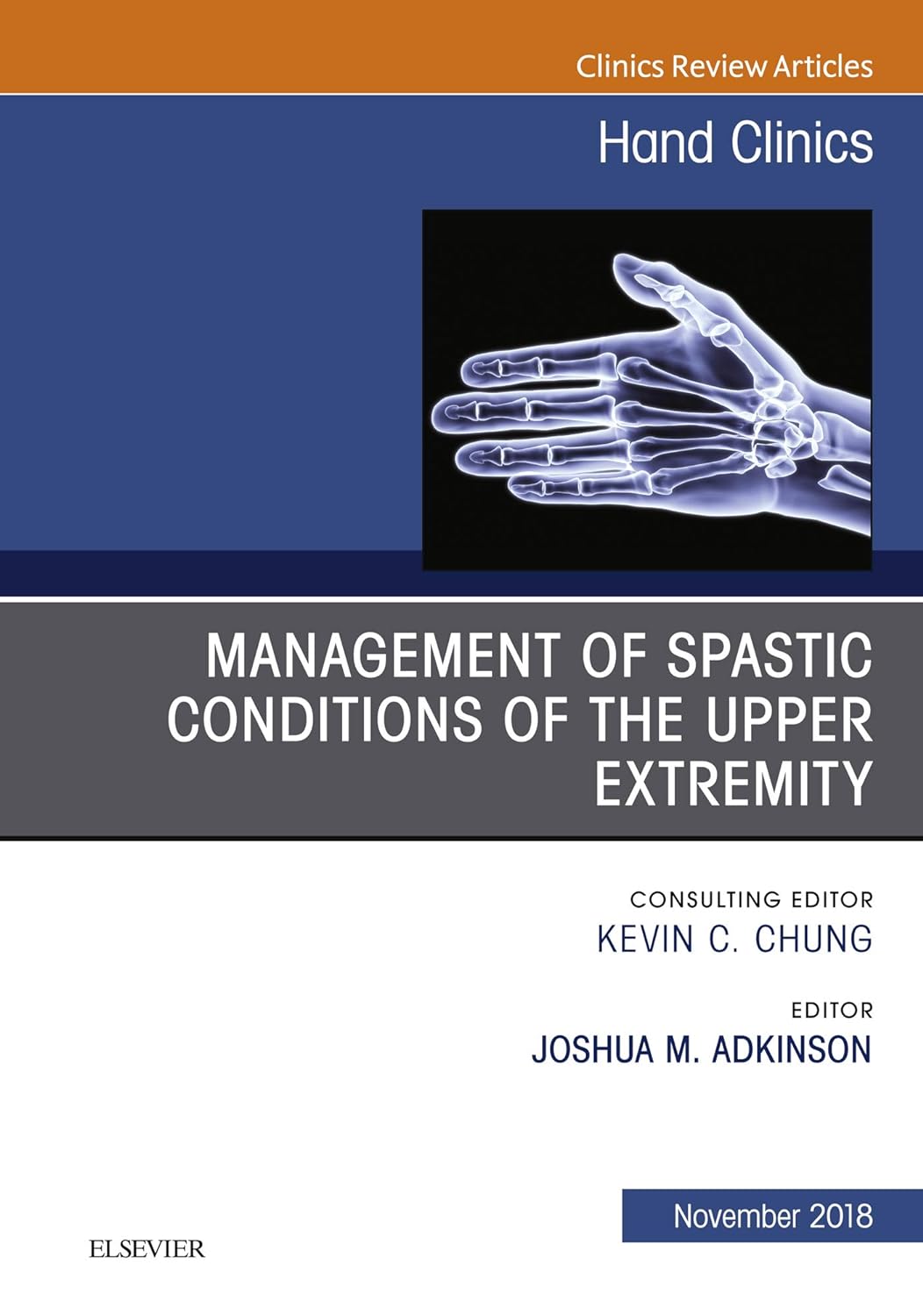 Management of Spastic Conditions of the Upper Extremity, An Issue of Hand Clinics (Volume 34-4) (The Clinics: Orthopedics, Volume 34-4) by  Joshua M Adkinson 