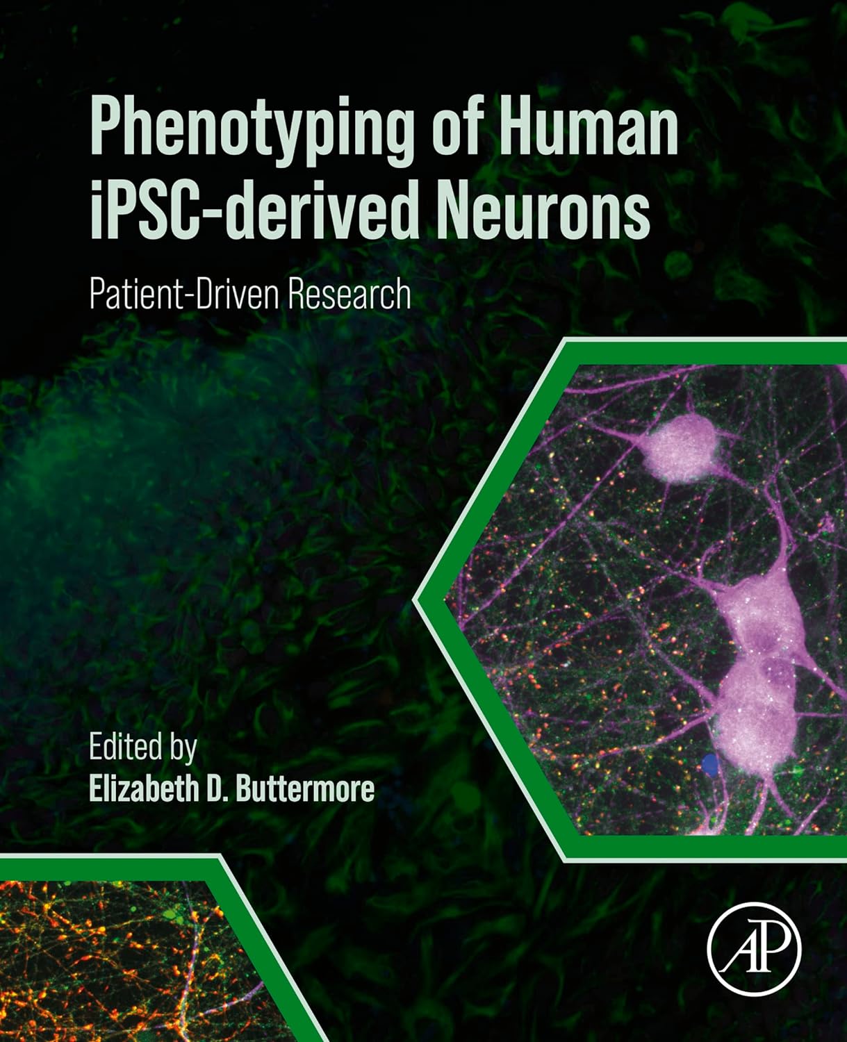 Phenotyping of Human iPSC-derived Neurons: Patient-Driven Research by Elizabeth D. Buttermore