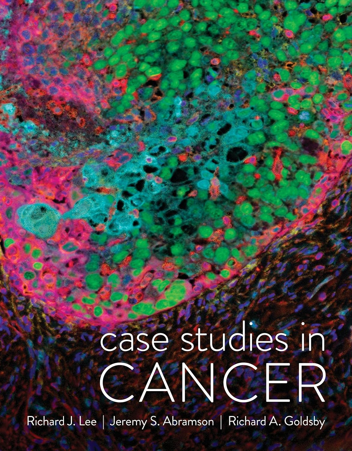 Case Studies in Cancer by  Richard J. Lee 