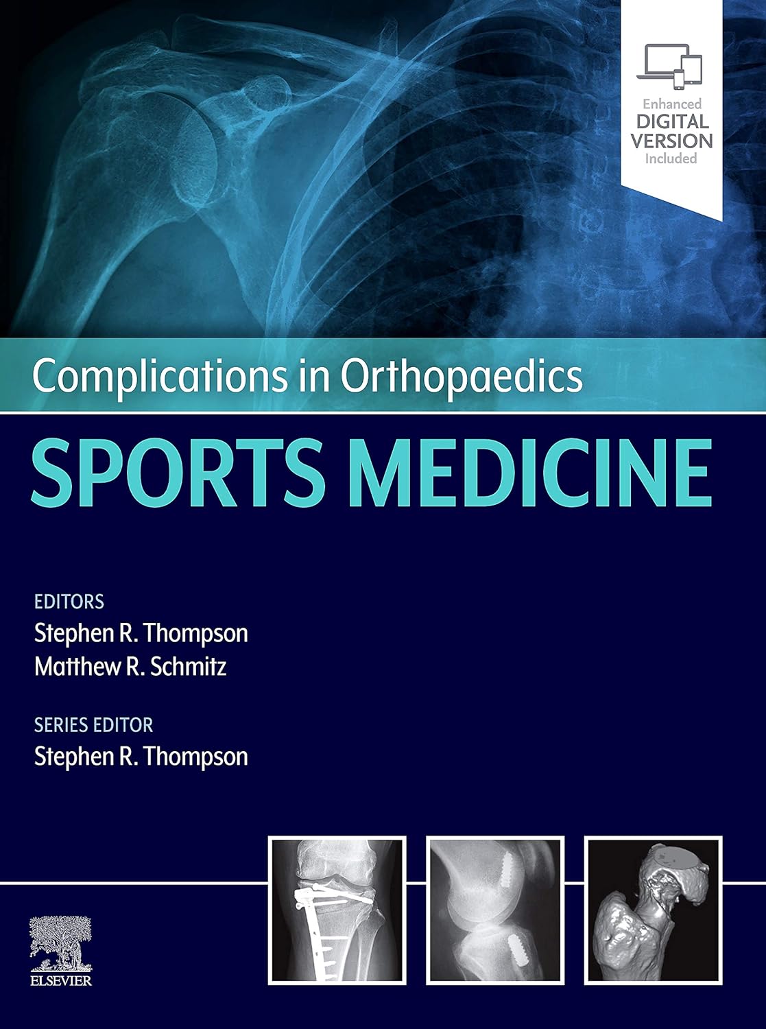 Complications in Orthopaedics: Sports Medicine  by  Stephen R. Thompson MD MEd FRCSC 