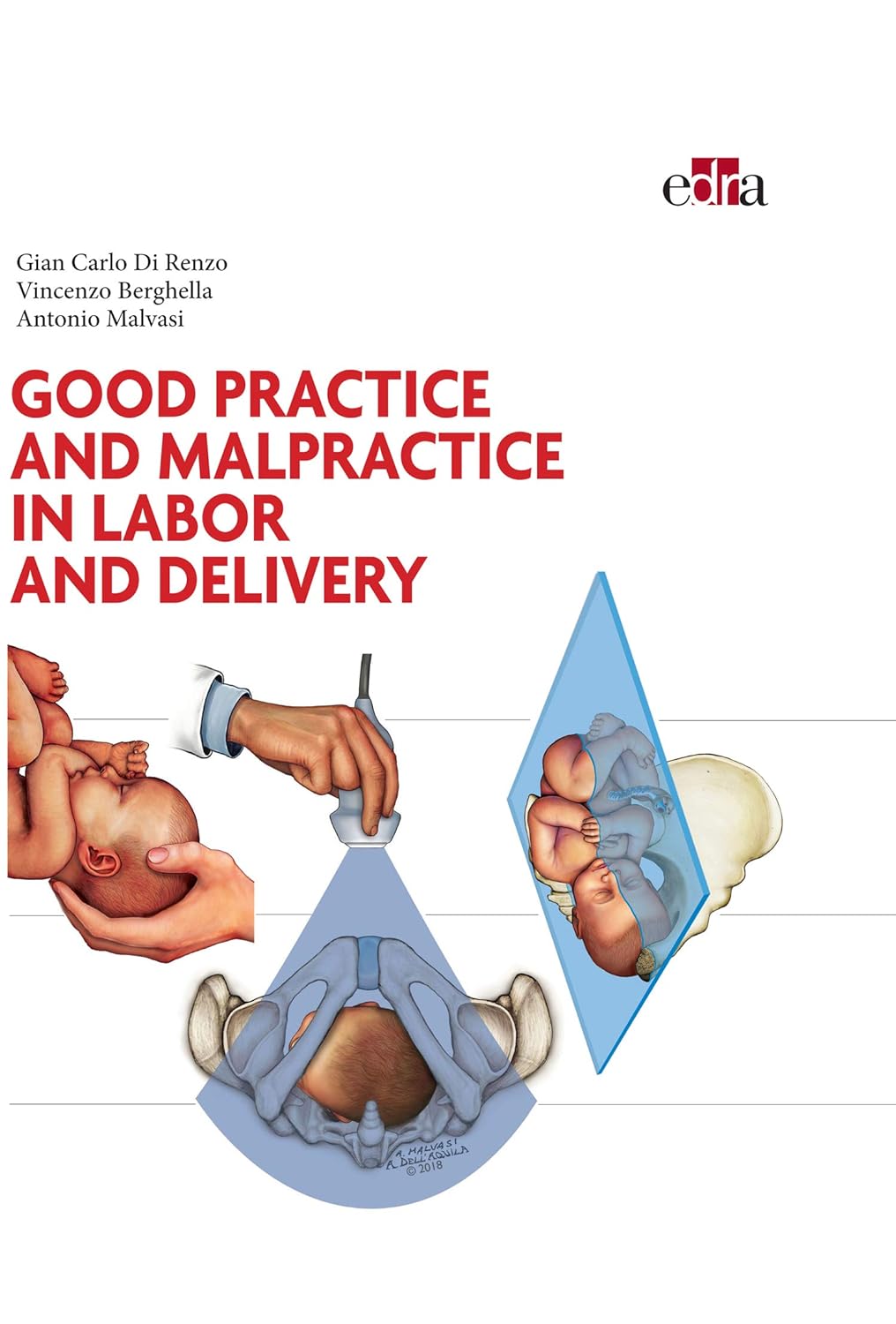 Good Practice and malpractice in labor and delivery by  Gian Carlo Di Renzo