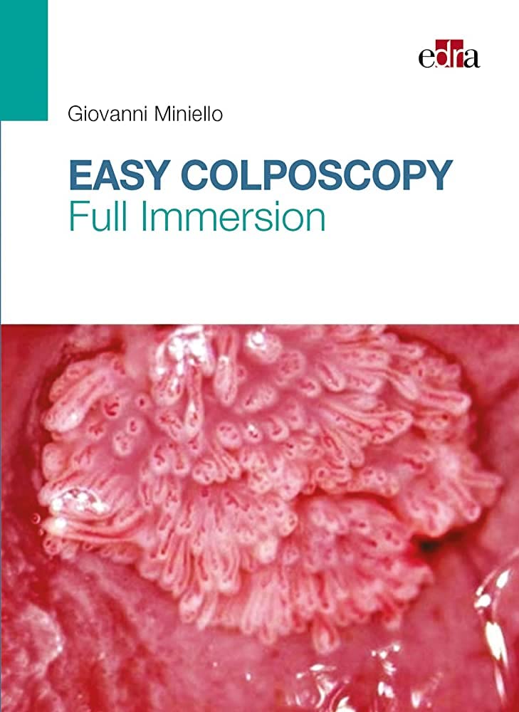 Easy colposcopy: Full Immersion  by Giovanni Miniello 