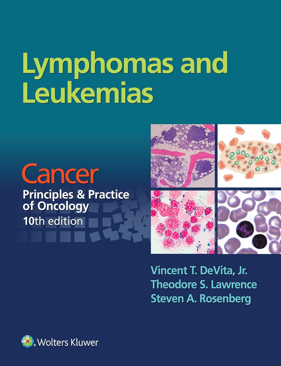 Lymphomas and Leukemias: Cancer: Principles ＆amp; Practice of Oncology, 10th Edition  by  Vincent DeVita
