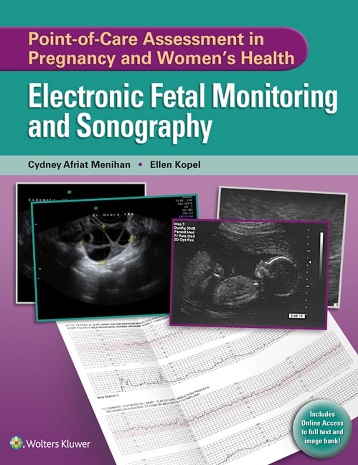 Point-of-Care Assessment in Pregnancy and Women s Health: Electronic Fetal Monitoring and Sonography  by  Cydney A. Menihan 
