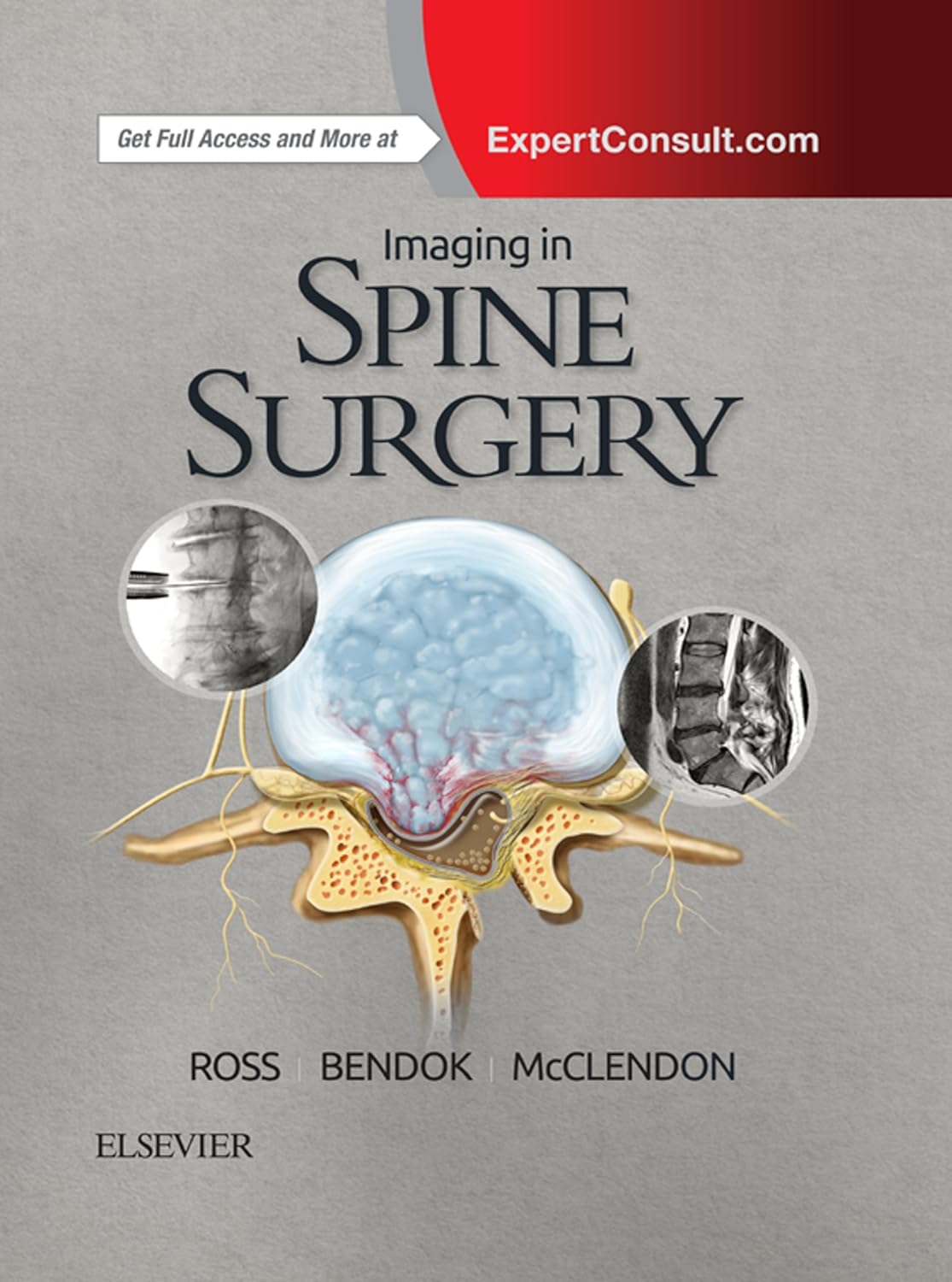 Imaging in Spine Surgery (Hot Topics)  by  Jeffrey S. Ross