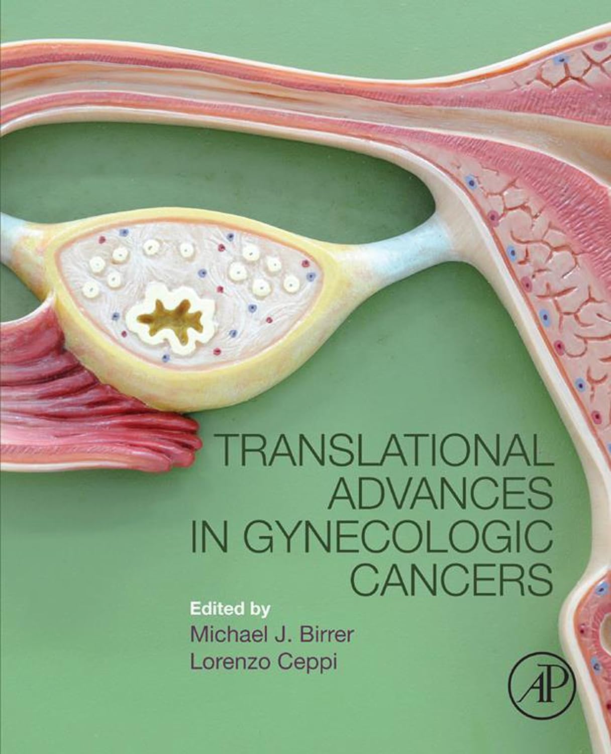Translational Advances in Gynecologic Cancers by  Michael Birrer