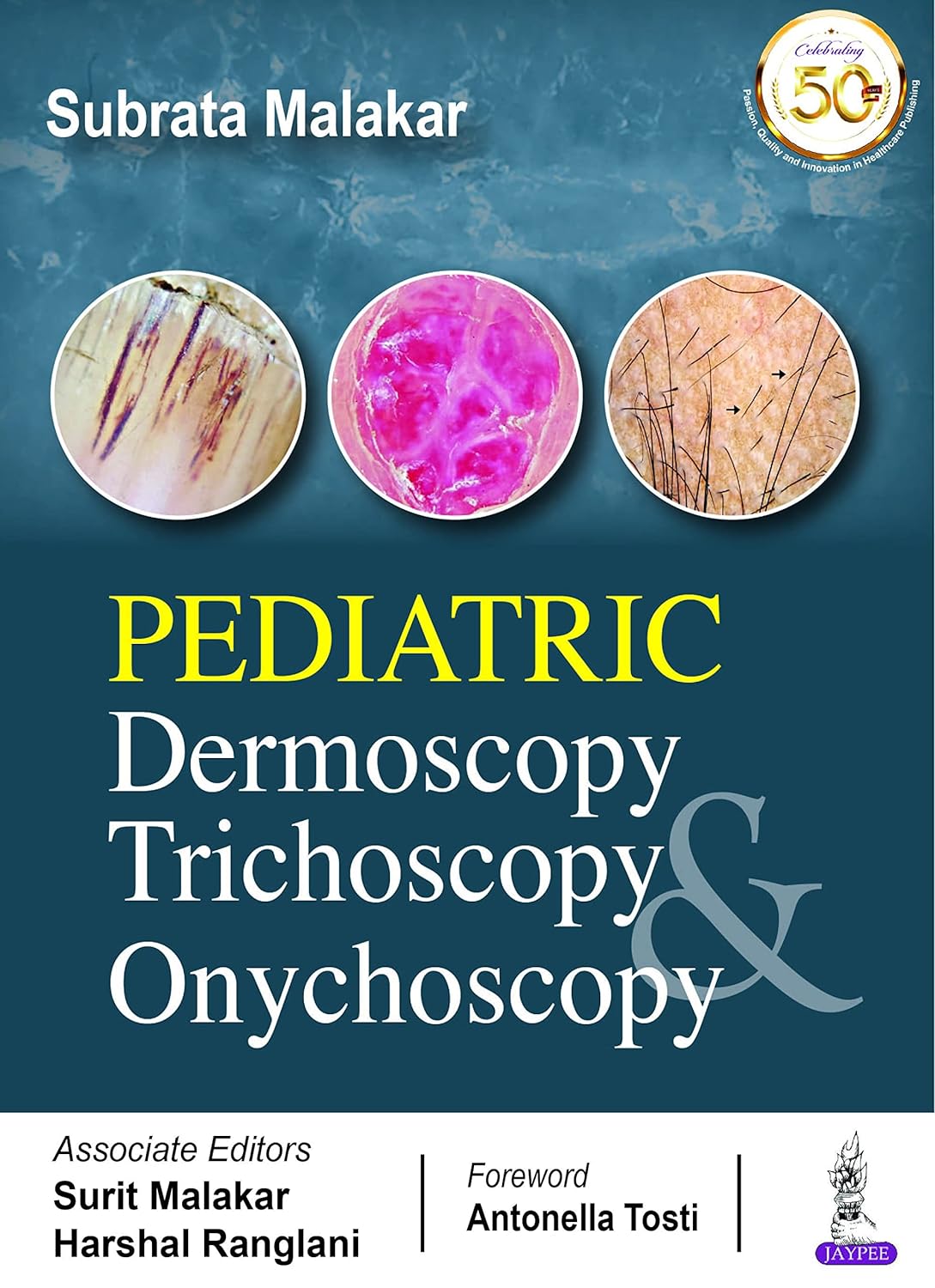 Pediatric Dermoscopy, Trichoscopy And Onychoscopy  by Subrata Malakar