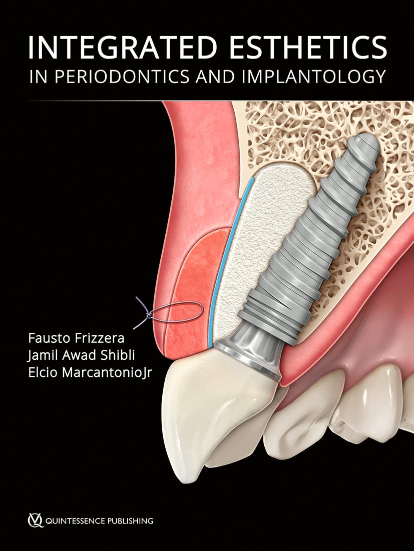 (EBook PDF)Integrated Esthetics in Periodontics and Implantology by  Fausto Frizzera