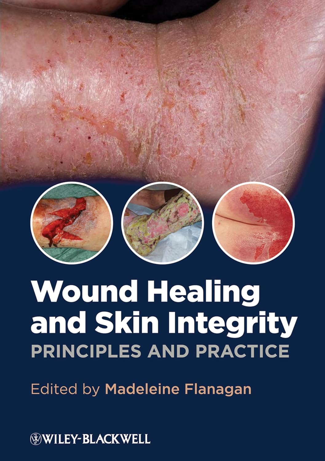 (EBook PDF)Wound Healing and Skin Integrity Principles and Practice 1st Edition by Madeleine Flanagan