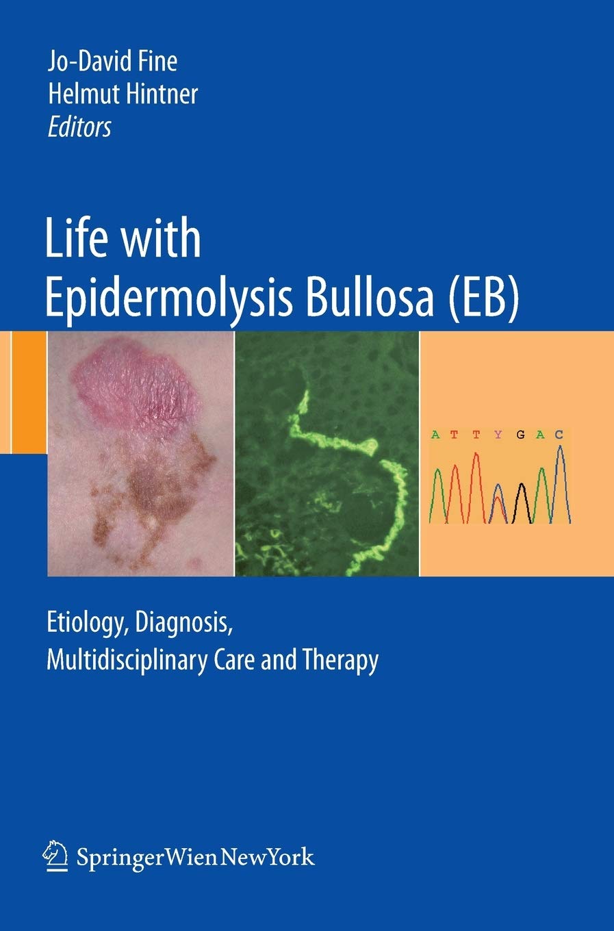 (EBook PDF)Life with Epidermolysis Bullosa (EB) Etiology, Diagnosis, Multidisciplinary Care and Therapy 2009th Edition by Jo-David Fine, Helmut Hintner