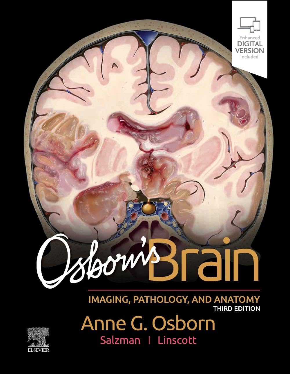 (EBook PDF)Osborn s Brain, 3rd Edition by Anne G. Osborn MD FACR, Luke L. Linscott MD, Karen L. Salzman MD