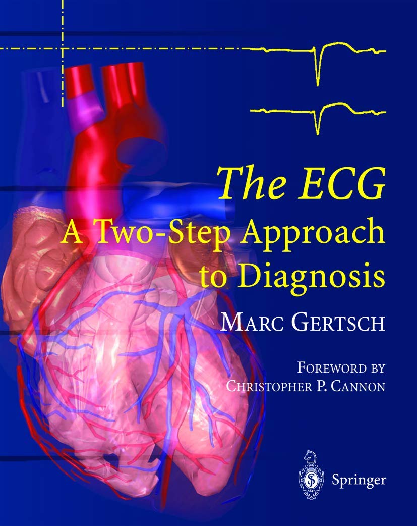 (EBook PDF)The ECG A Two-Step Approach to Diagnosis by Marc Gertsch, C.P. Cannon