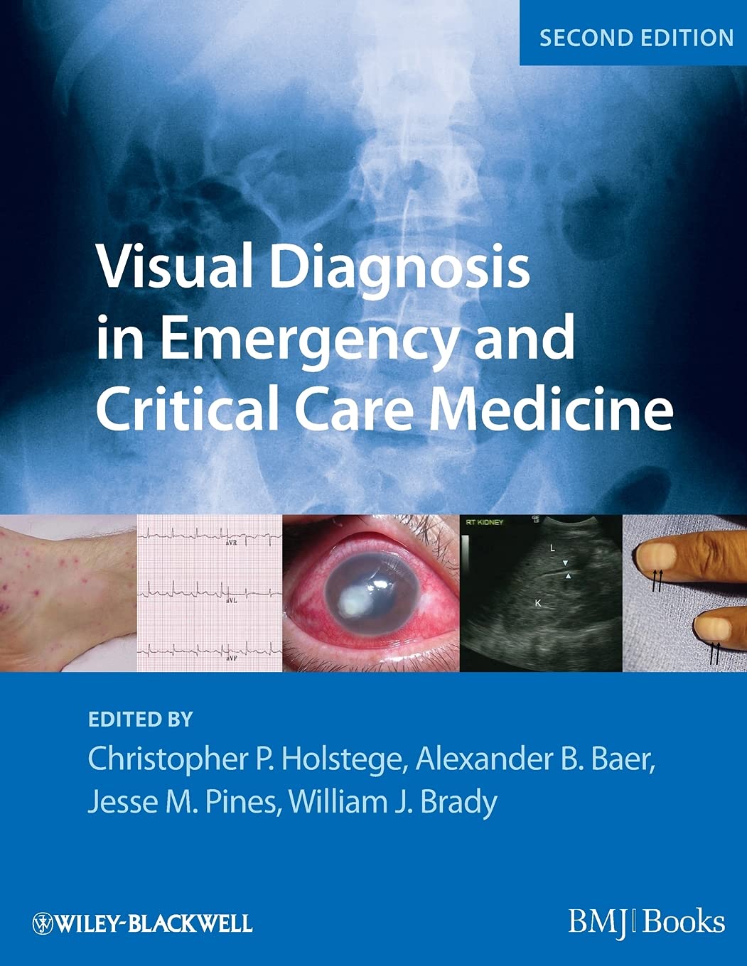 (EBook PDF)Visual Diagnosis in Emergency and Critical Care Medicine by Christopher P Holstege MD, Alexander B Baer, Jesse M Pines, William J Brady