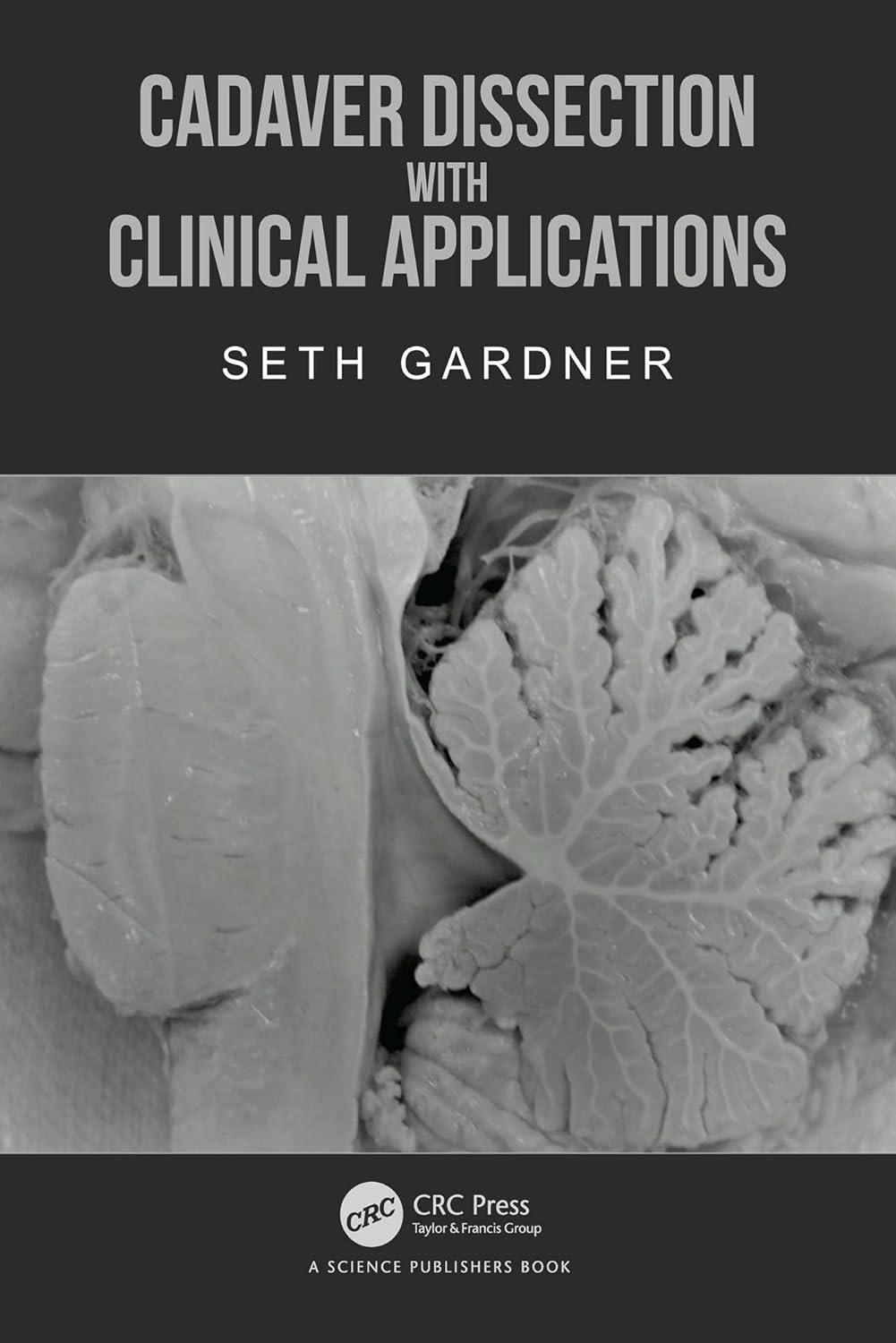 (EBook PDF)Cadaver Dissection with Clinical Applications by Seth Gardner