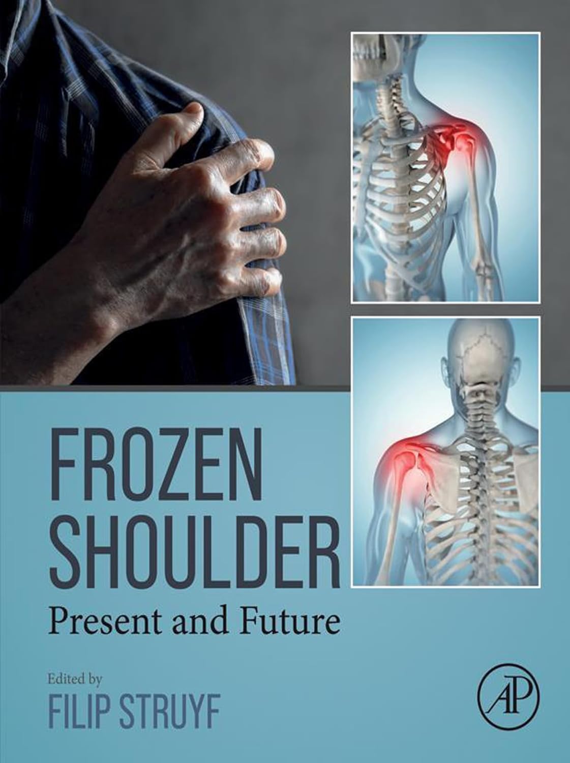 (EBook PDF)Frozen Shoulder: Present and Future by Filip Struyf PhD