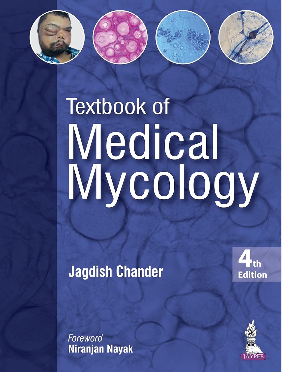(EBook PDF)Textbook of Medical Mycology 4th Edition by M.D. Chander, Jagdish, Dr.