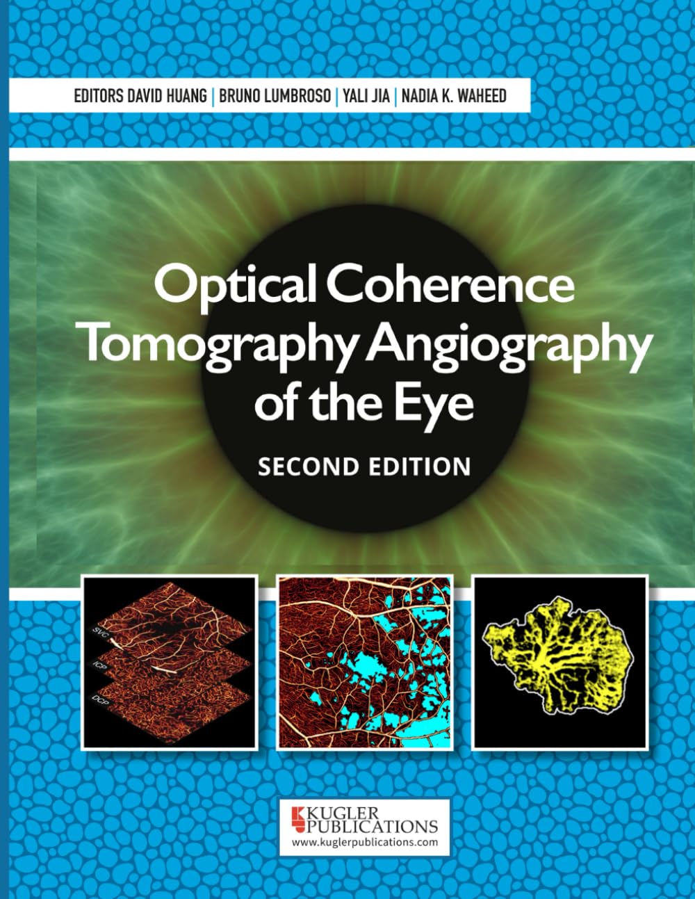 (EBook PDF)Optical Coherence Tomography Angiography of the Eye, 2nd edition by David Huang, Bruno Lumbroso, Yali Jia, Nadia K. Waheed