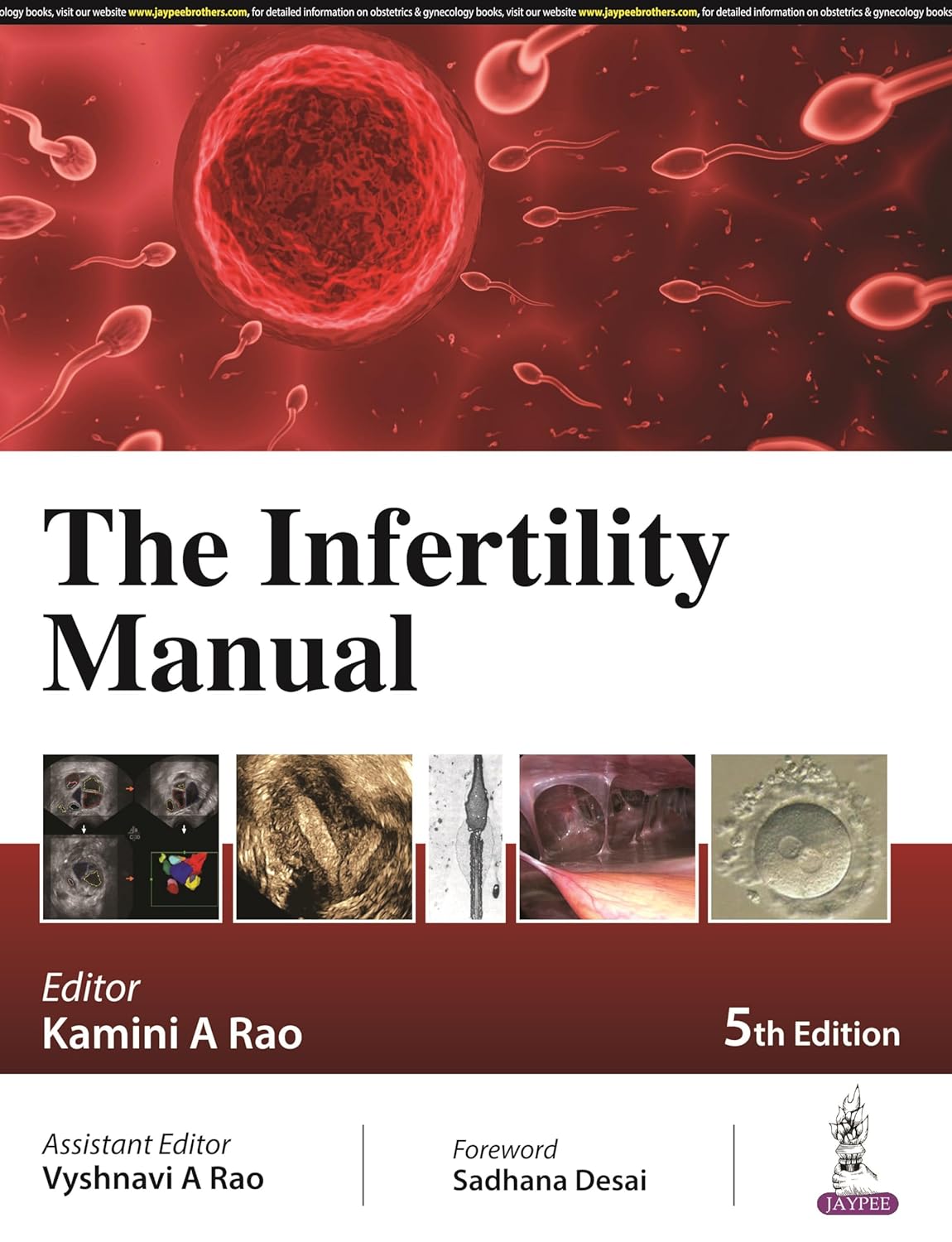 (EBook PDF)The Infertility Manual, 5th edition by Kamini A Rao, Vyshnavi A Rao