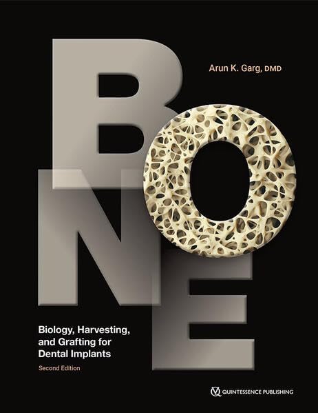 (EBook PDF)Bone: Biology, Harvesting, and Grafting for Dental Implants, 2nd edition by Arun K. Garg