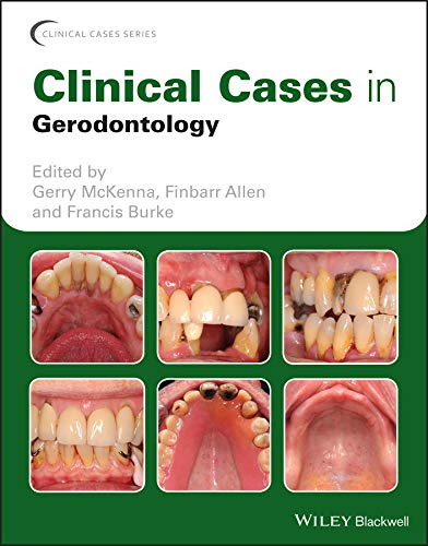 (EBook PDF)Clinical Cases in Gerodontology (Clinical Cases (Dentistry) by Gerry McKenna, Finbarr Allen, Francis Burke