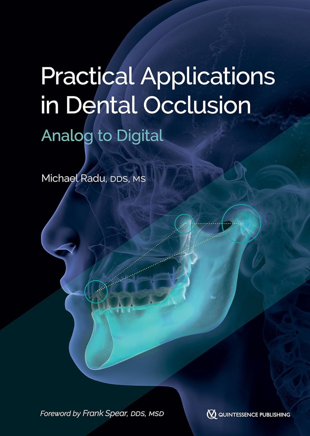 (EBook PDF)Practical Applications in Dental Occlusion: Analog to Digital by Michael Radu, Frank Spear, Daniel Radu, Lee Culp