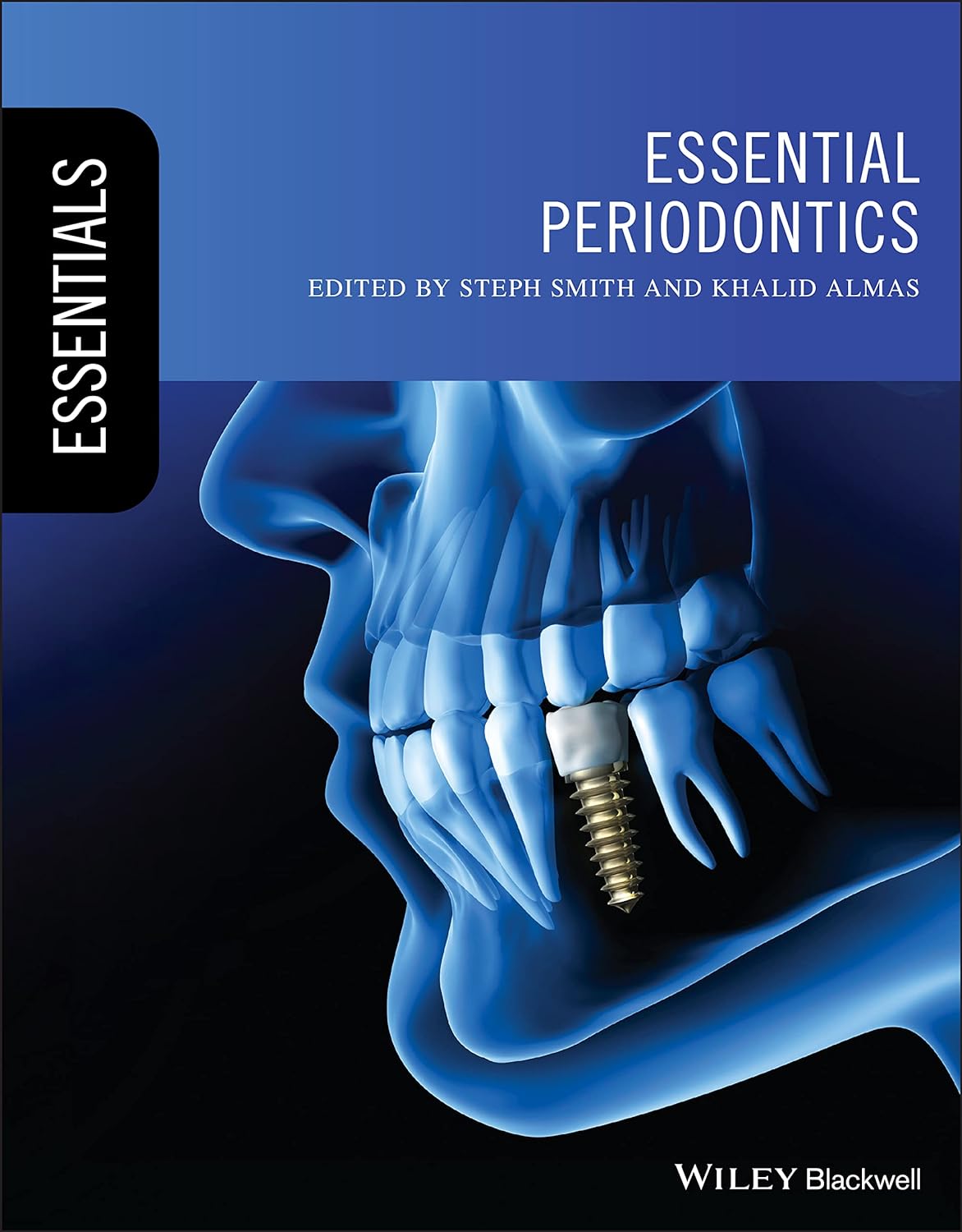 (EBook PDF)Essential Periodontics (Essentials (Dentistry) by Steph Smith, Khalid Almas