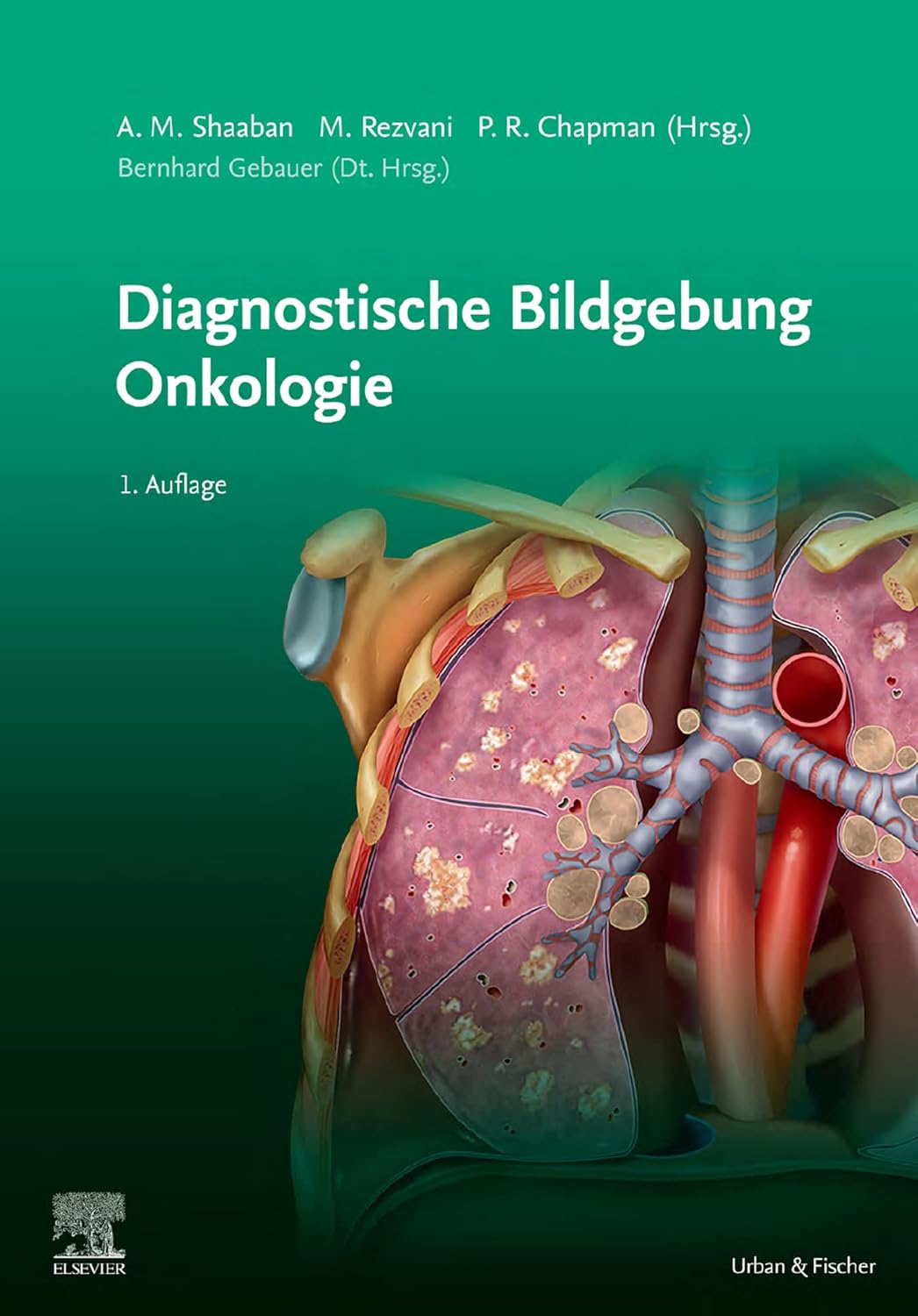 (EBook PDF)Diagnostische Bildgebung Onkologie by unknown author