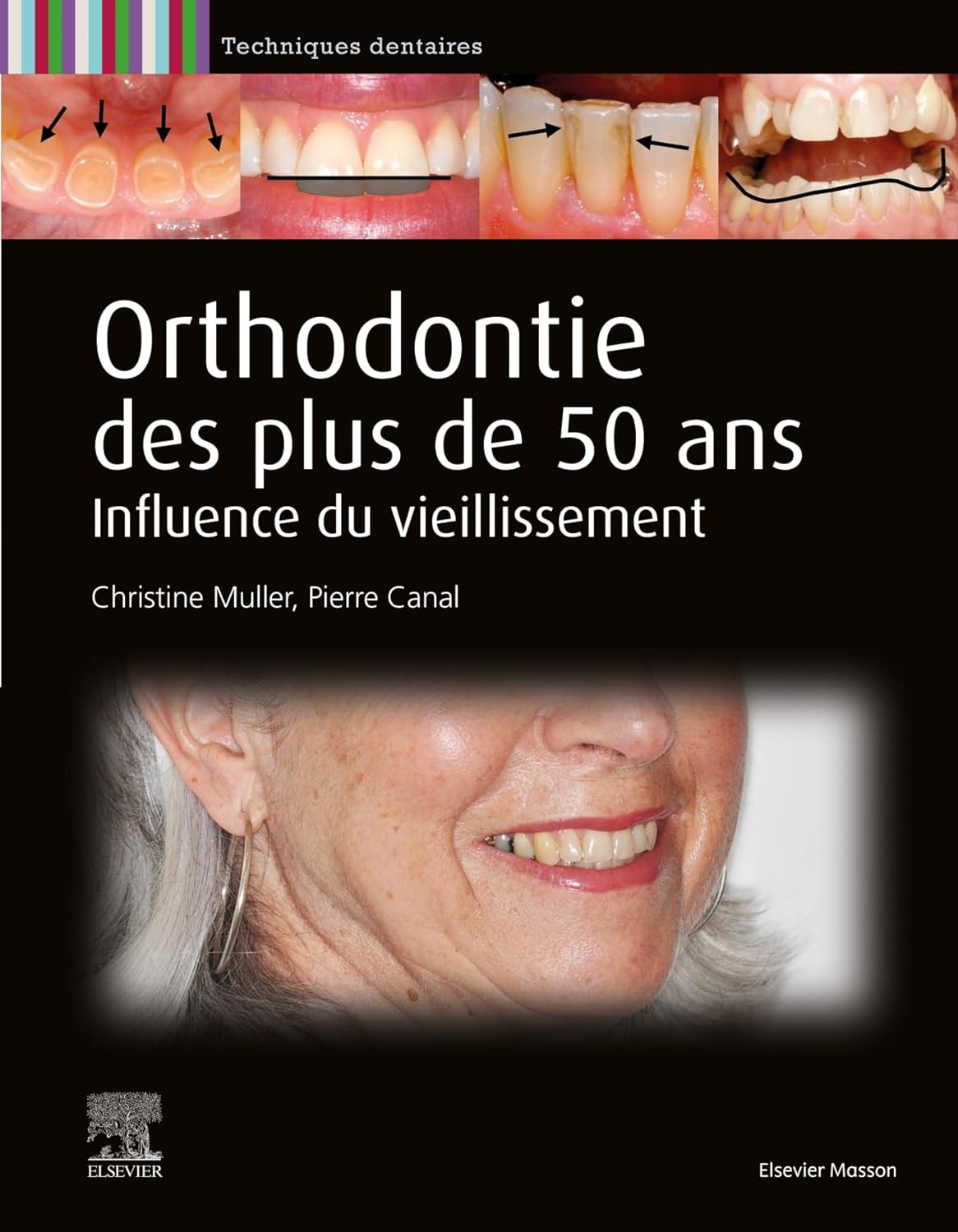 (EBook PDF)Orthodontie des plus de 50 ans: Influence du vieillissement by Pierre Canal, Christine Muller, Alain B＆eacute;ry