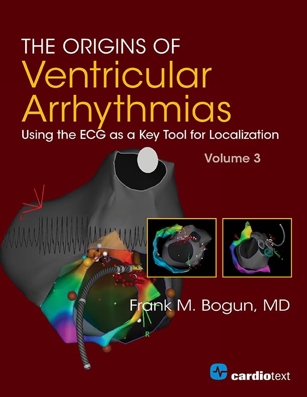 (EBook PDF)The Origins of Ventricular Arrhythmias: Using the ECG as a Key Tool for Localization, Volume 3 by Frank M. Bogun