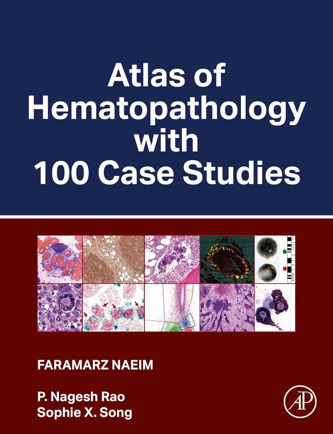 (EBook PDF)Atlas of Hematopathology with 100 Case Studies by Faramarz Naeim MD, P. Nagesh Rao, Sophie X. Song