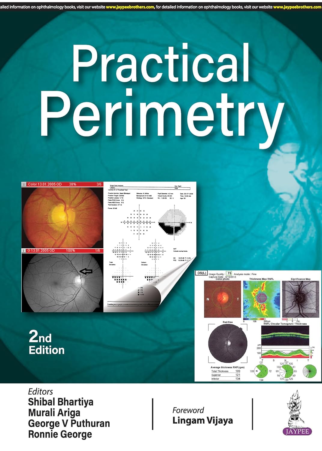 (EBook PDF)Practical Perimetry, 2nd edition by Shibal Bhartiya, Murali Ariga, George V Puthuran, Ronnie George