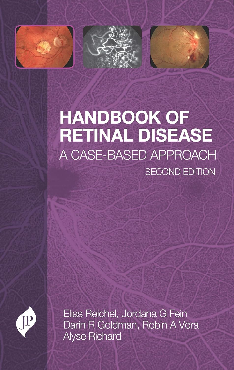 (EBook PDF)Handbook of Retinal Disease: A Case- Based Approach, 2ed by Elias Reichel, Jordana G Fein, Darin R Goldman, Robin A Vora, Alyse Richard