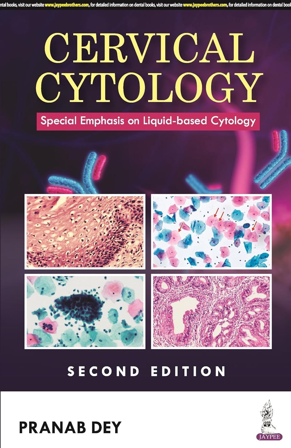 (EBook PDF) Cervical Cytology: Special Emphasis on Liquid-based Cytology, 2ed by Pranab Dey