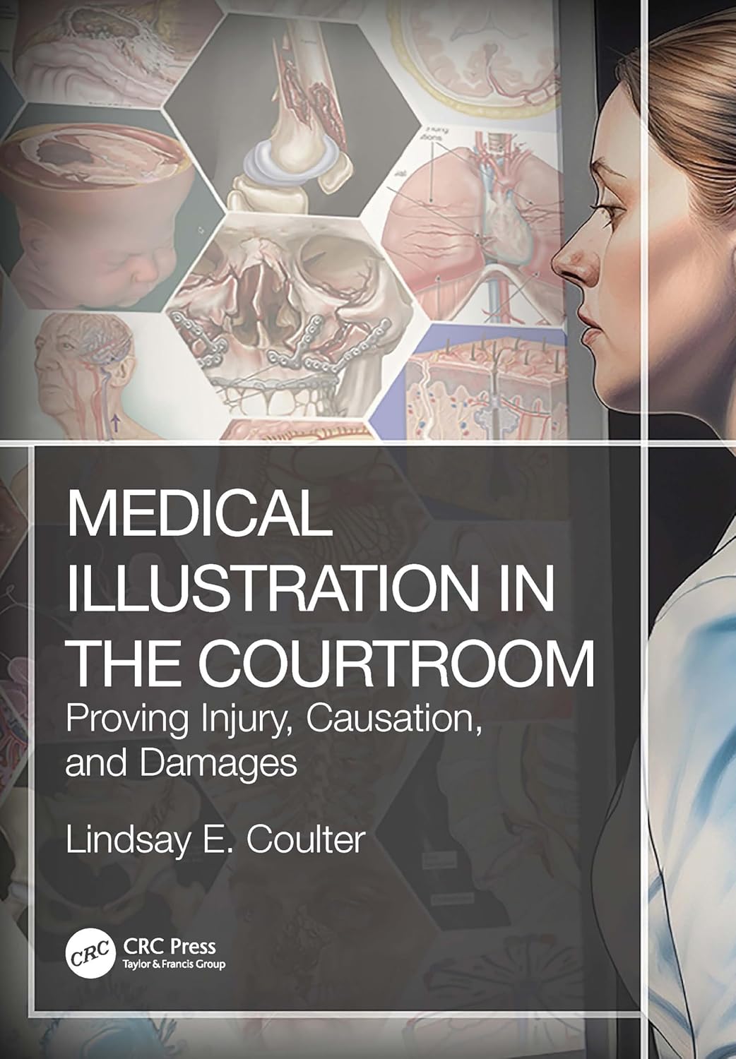 (EBook PDF)Medical Illustration in the Courtroom: Proving Injury, Causation, and Damages by  Lindsay E. Coulter