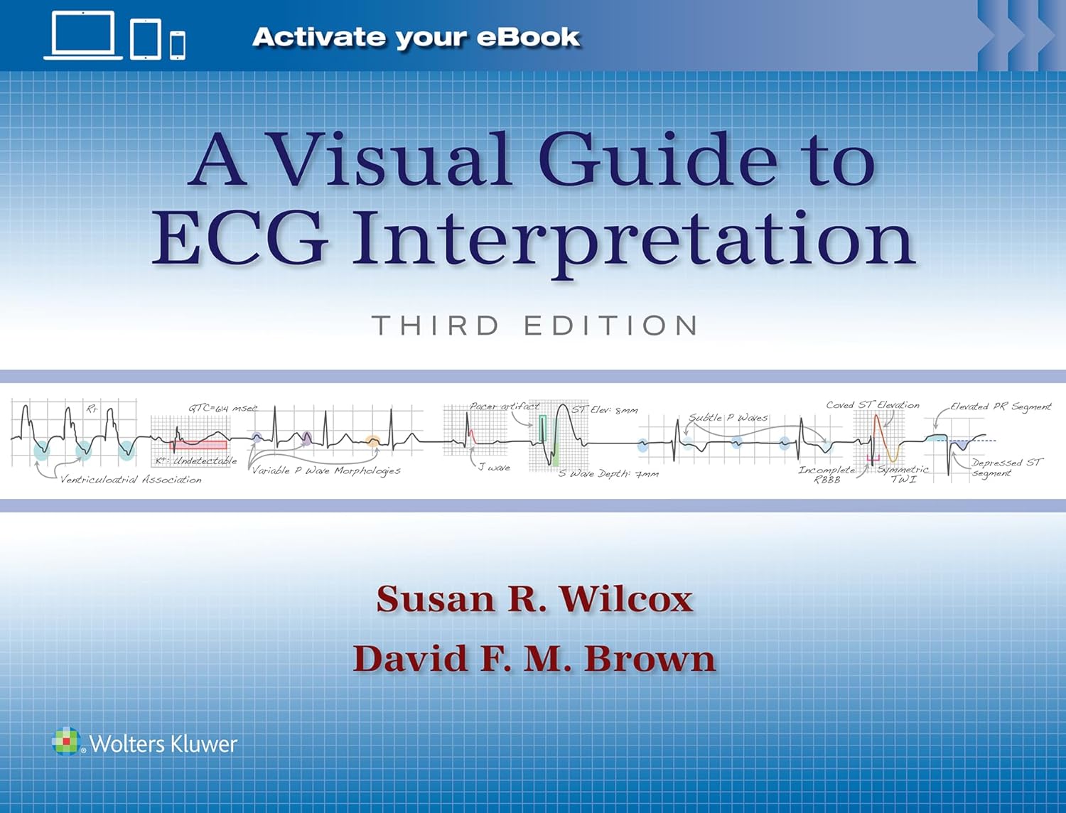 (EBook PDF)A Visual Guide to ECG Interpretation, 3rd Edition by Susan Renee Wilcox, DAVID F. M. BROWN