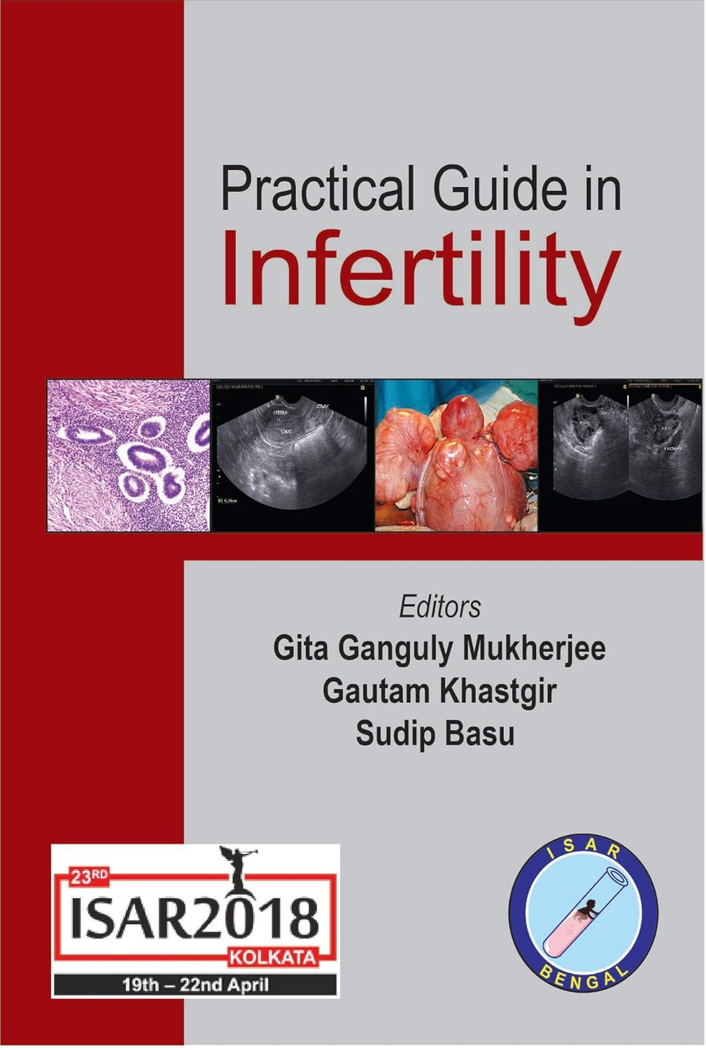 (EBook PDF)Practical Guide in Infertility by Gita Ganguly Mukherjee, Gautam Khastgir, Sudip Basu