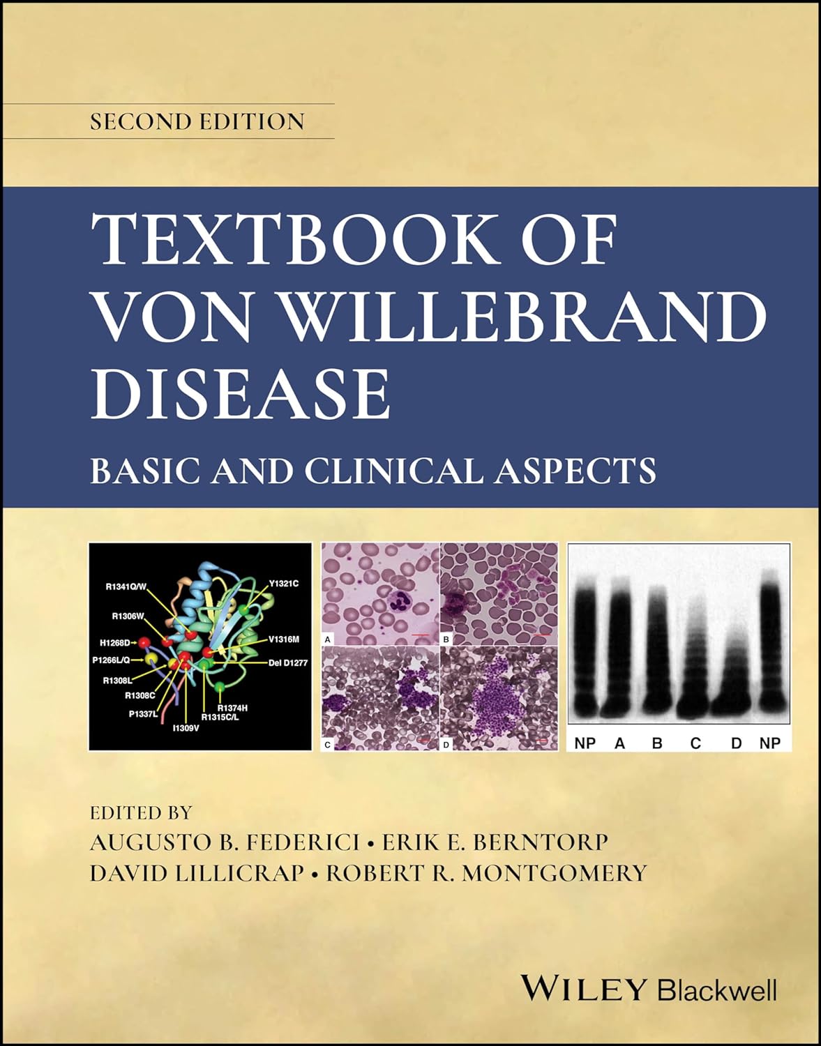 (EBook PDF)Textbook of Von Willebrand Disease, 2nd Edition by Augusto B. Federici, Erik E. Berntorp, David Lillicrap, Robert R. Montgomery