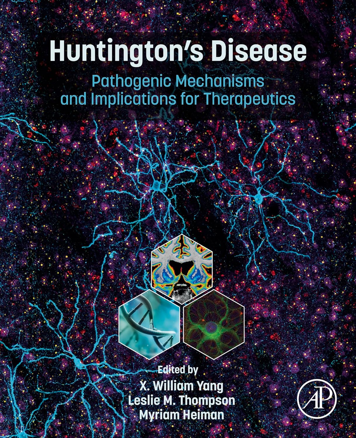 (EBook PDF)Huntington s Disease Pathogenic Mechanisms and Implications for Therapeutics 1st Edition by X. William Yang, Myriam Heiman, Leslie M. Thompson 