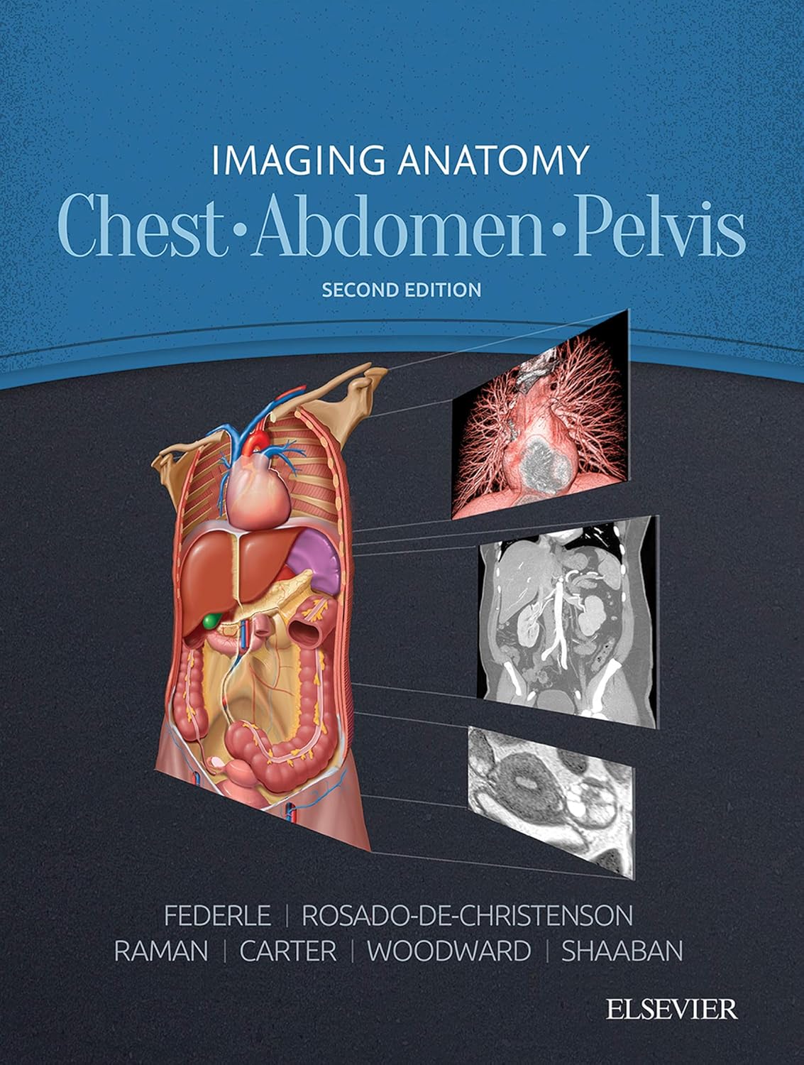 IMAGING ANATOMY Chest.Abdomen.Pelvis SECOND EDITION by Michael P Federle