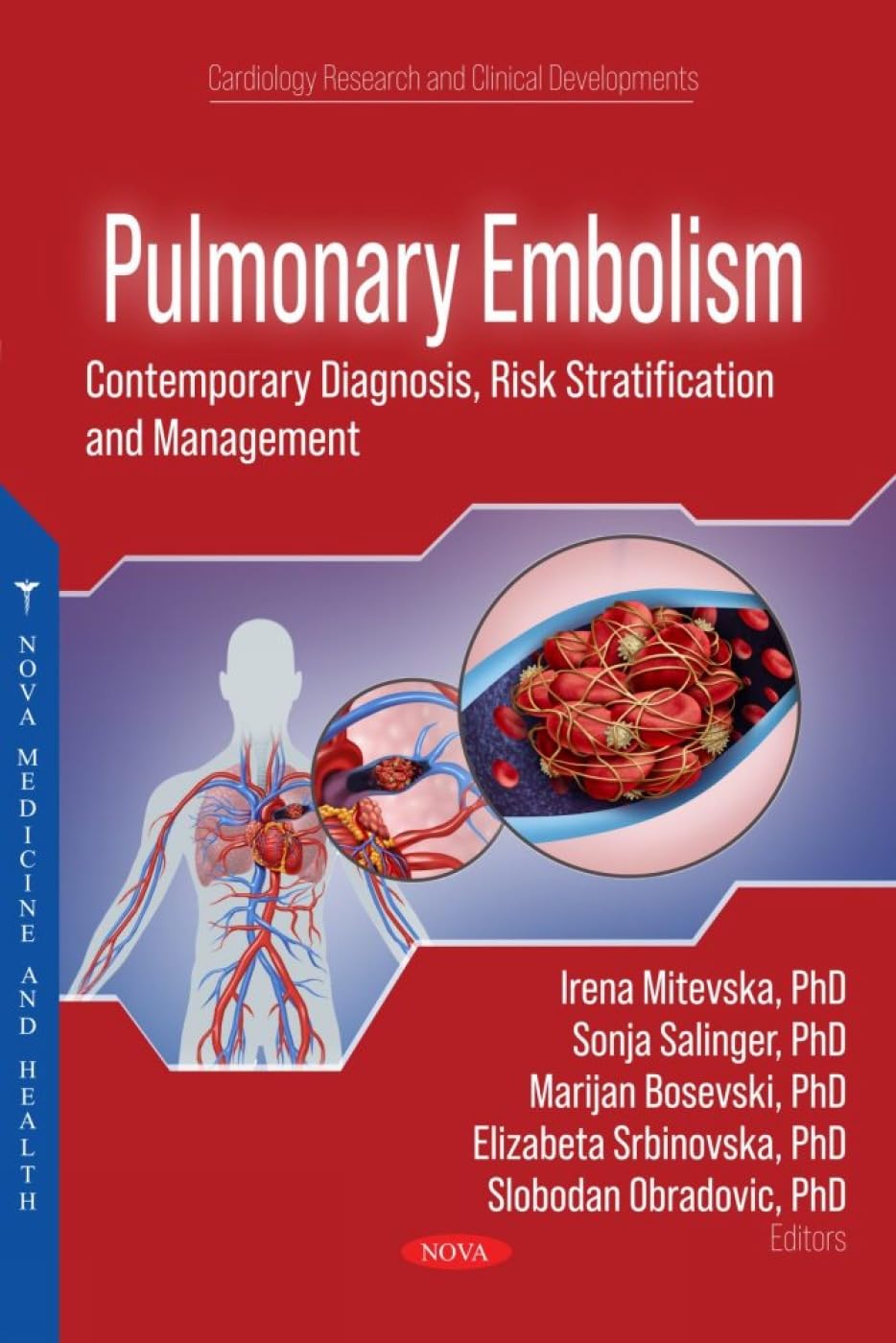 (EBook PDF)Pulmonary Embolism: Contemporary Diagnosis, Risk Stratification and Management by  Irena Mitevska