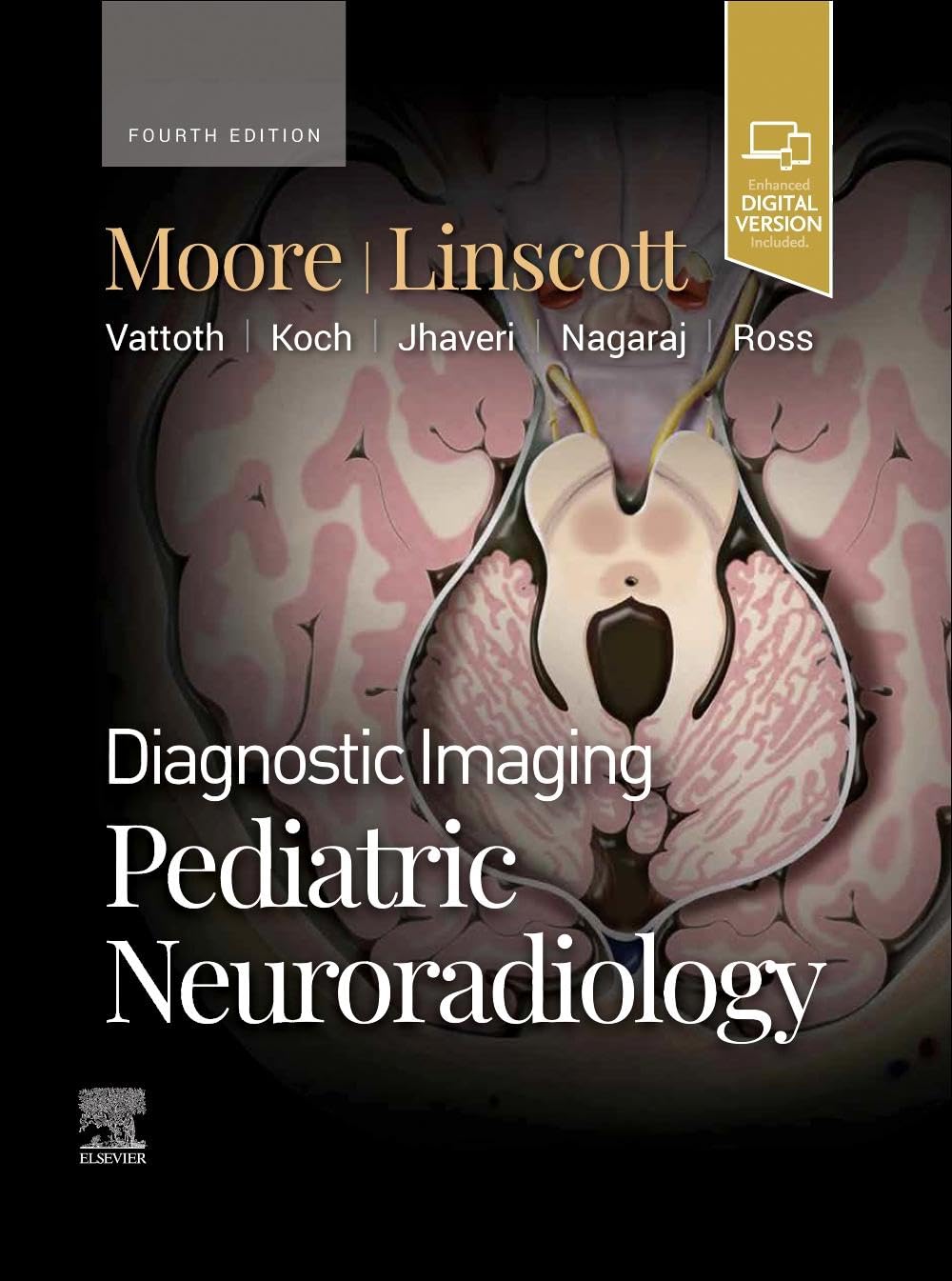 (EBook PDF)Diagnostic Imaging: Pediatric Neuroradiology, 4th edition by Kevin R. Moore MD , Luke L. Linscott MD