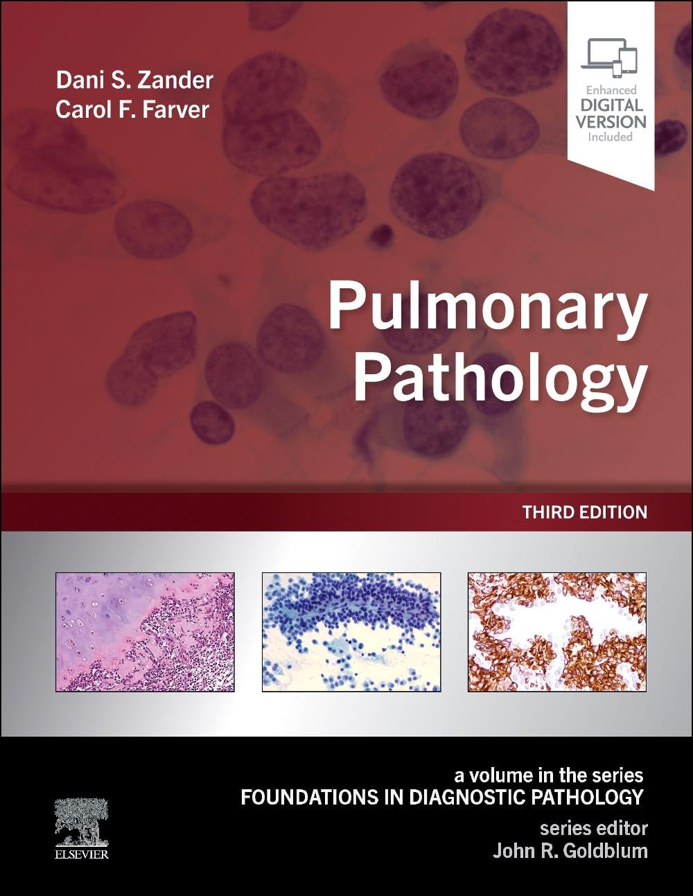 (EBook PDF)Pulmonary Pathology (Foundations in Diagnostic Pathology), 3rd edition by Dani S. Zander MD, Carol F. Farver MD, John R. Goldblum MD FCAP FASCP FACG