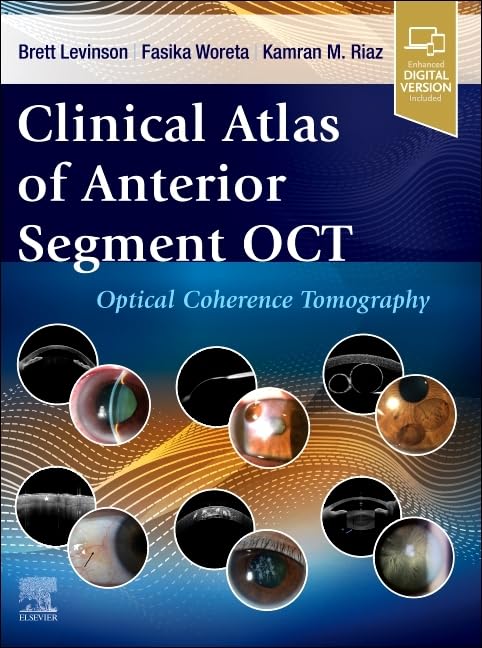 (EBook PDF)Clinical Atlas of Anterior Segment OCT: Optical Coherence Tomography by Brett Levinson MD, Fasika Woreta MD MPH, Kamran Riaz MD