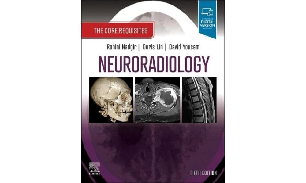 (EBook PDF)Neuroradiology: The Core Requisites, 5th edition by Rohini Nadgir MD, Doris Lin, David M. Yousem MD MBA