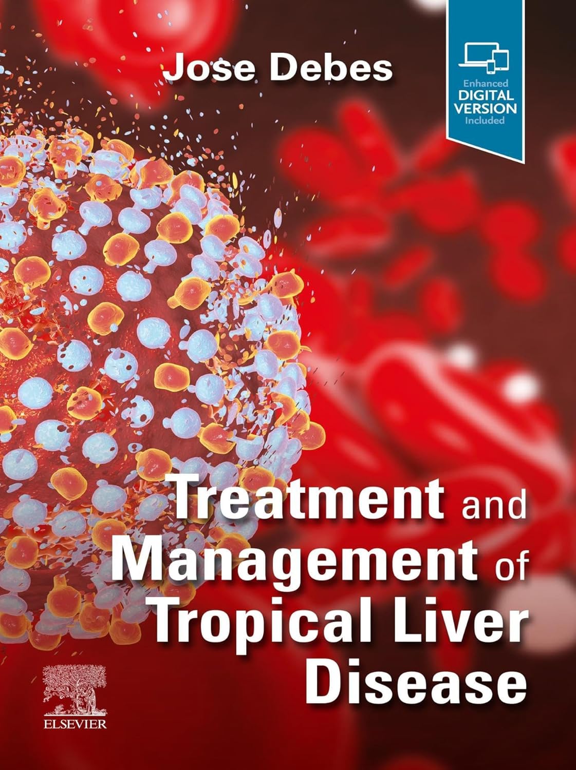 (EBook PDF)Treatment and Management of Tropical Liver Disease 1st Edition by Jose Debes