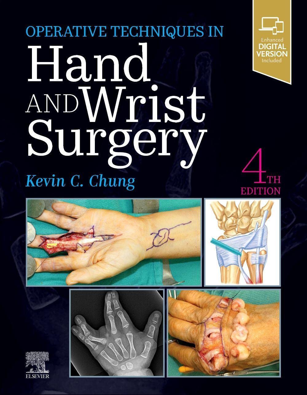 Operative Techniques: Hand and Wrist Surgery, 4th Edition  by Kevin C. Chung MD MS 