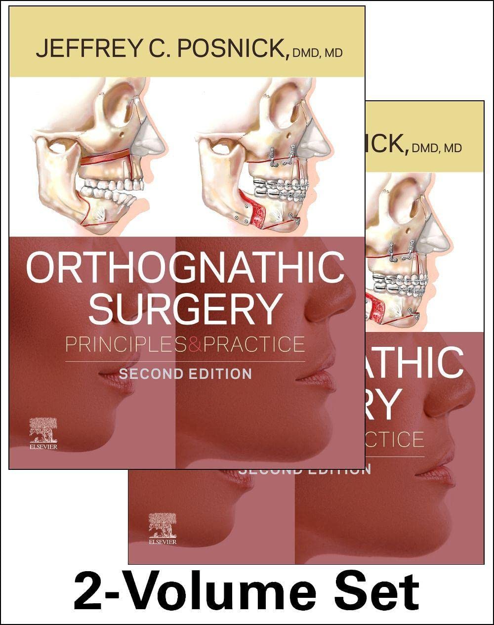 Orthognathic Surgery - 2 Volume Set: Principles and Practice, 2nd Edition  by Jeffrey C. Posnick D.M.D. M.D. F.R.C.S. (C) F.A.C.S. 