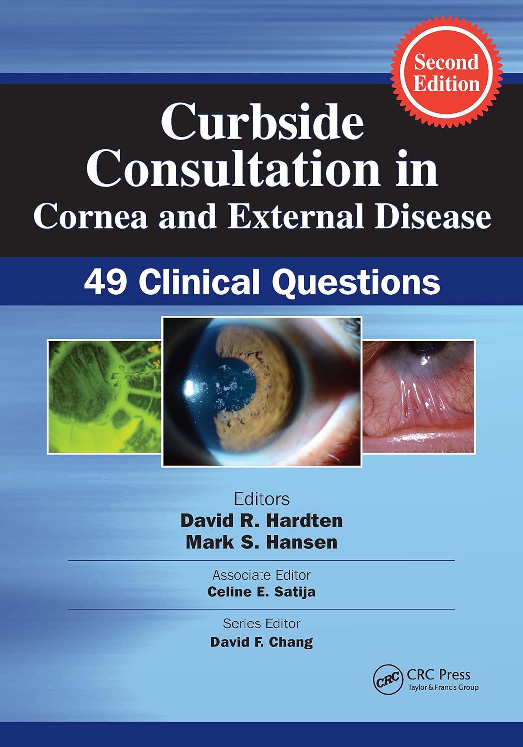 Curbside Consultation in Cornea and External Disease: 49 Clinical Questions, 2nd Edition  by David R. Hardten 