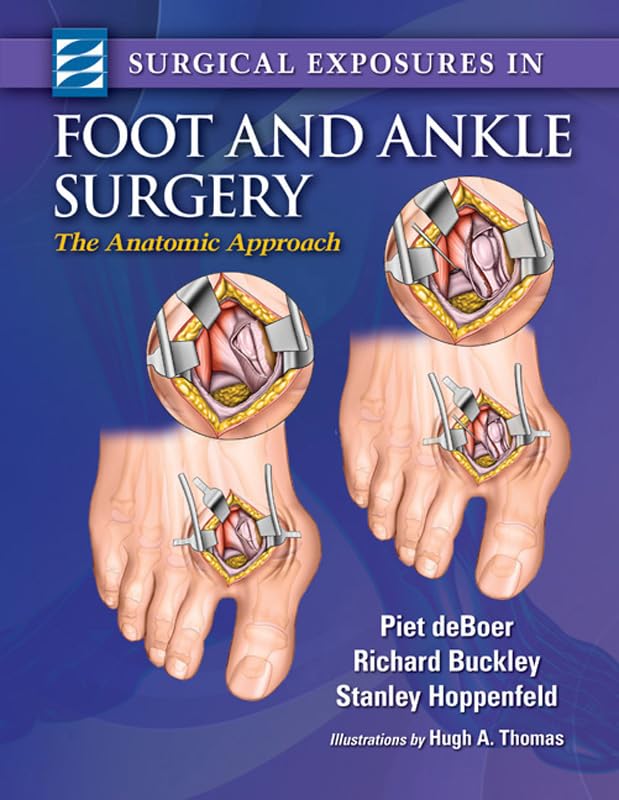 Surgical Exposures in Foot and Ankle Surgery: The Anatomic Approach, 2nd Edition  by Piet deBoer